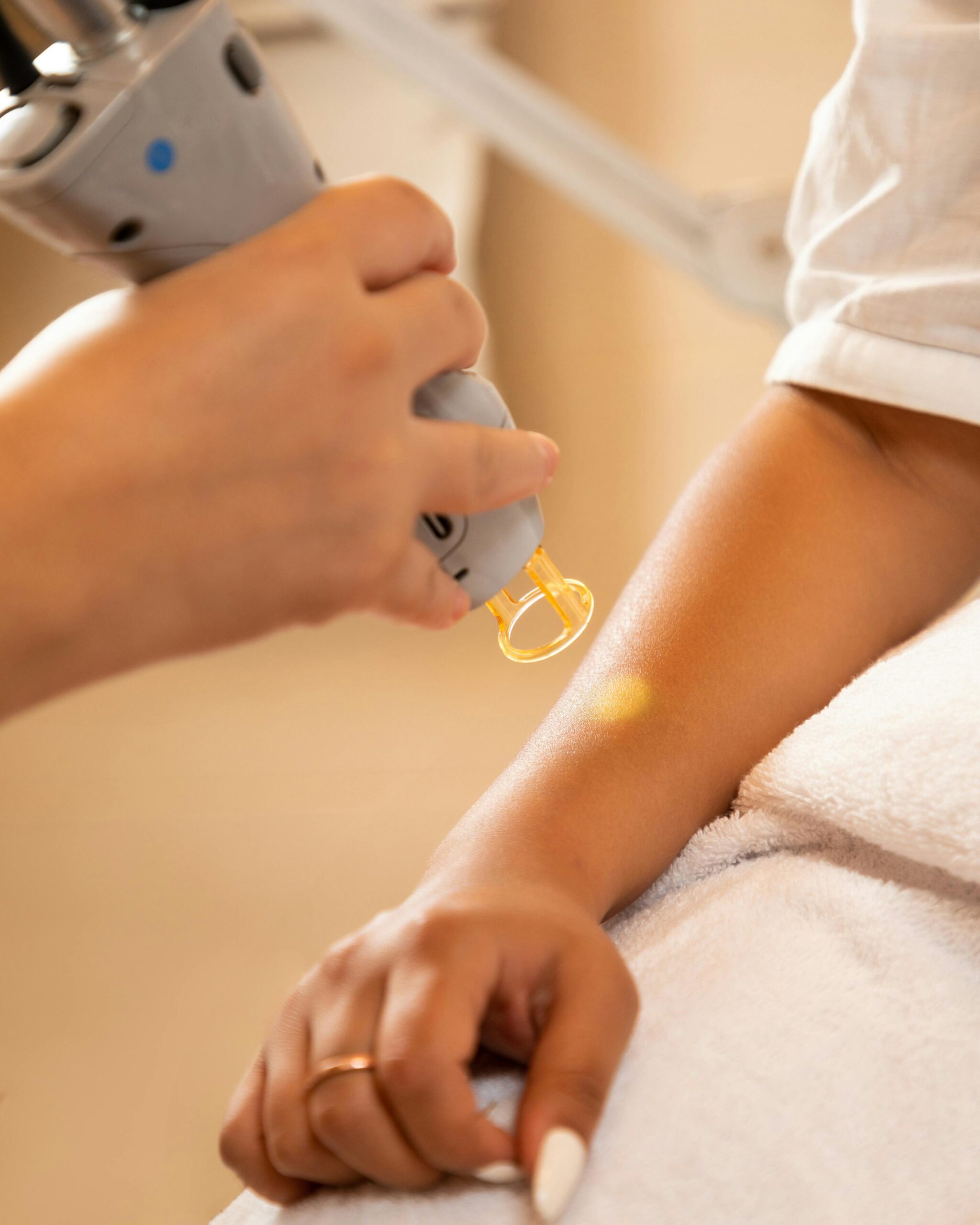 Laser hair removal on a client's arm