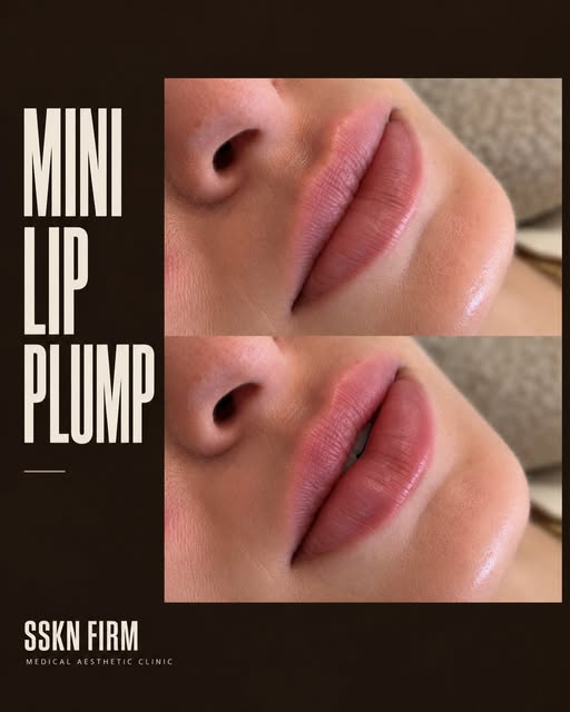 Main Home Mini lip plump before and after at SSKN Firm